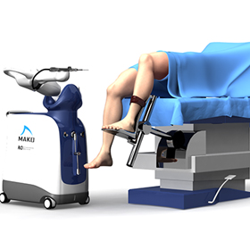 Mako Robotic-Arm Assisted Technology for Total Knee Replacement
