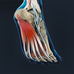Posterior Tibial Tendon