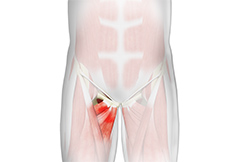 Picture of Athletic Pubalgia hip