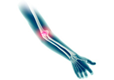 Elbow Pain