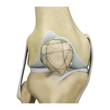 Surgical Treatment