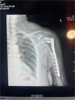 Patient Success Story 1-1