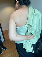 Patient Success Story 1-3