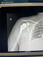 Patient Success Story 2-1