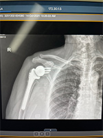 Patient Success Story 3-1