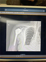 Patient Success Story 5-1