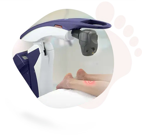 NEUROPATHY (Nerve Damage)