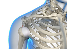 picture of Posterior Shoulder Stabilization