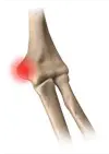 Picture of elbow