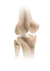 Picture of knee