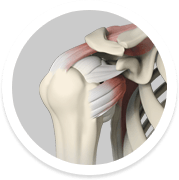 Rotator Cuff Repair1