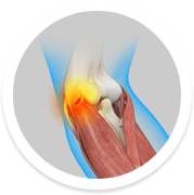 Tennis Elbow Surgery1