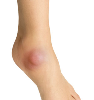 Ganglion & Soft Tissue Tumors