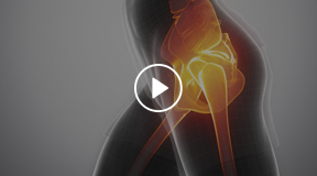 Patient Education Videos