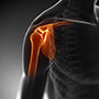 Procedures -  Labral Debridement and Repair 