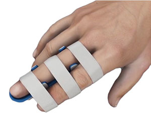 Hand Fracture Care