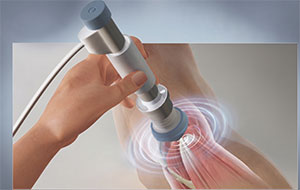 Shockwave Therapy for Joint Pain Management