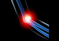 Elbow Injuries