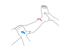 Nonoperative Treatments for ACL Injuries