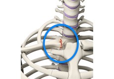 Sternoclavicular Joint Injuries