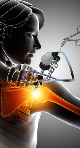 Arthroscopic Surgery Service