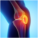 Image Outcomes and failure rates after revision meniscal repair