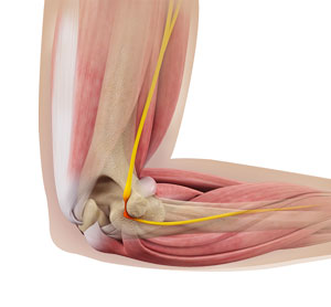 Ulnar Nerve Decompression