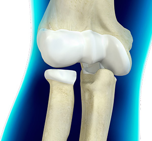 Elbow anatomy