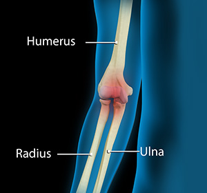 elbow-pain