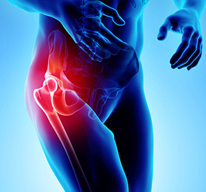 Hip Pain