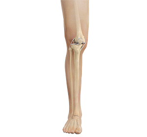 Knee Dislocation