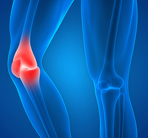 Knee Injury