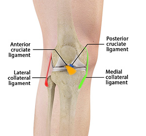 Multiligament Knee Injuries