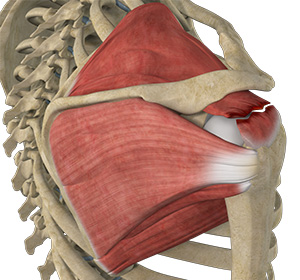 rotator-cuff-tear