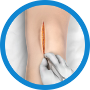 Minimally Invasive Arthroscopic Surgery