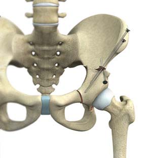 Hip Common Services
