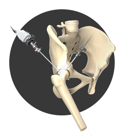 Arthroscopic Surgery - Expertise