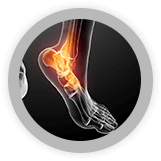 Services - Ankle