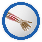 Services - Adult & Pediatric Fracture Care