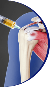 Orthobiologics