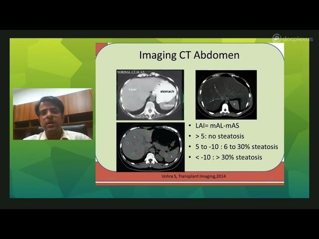 Obesity & Liver Diseases