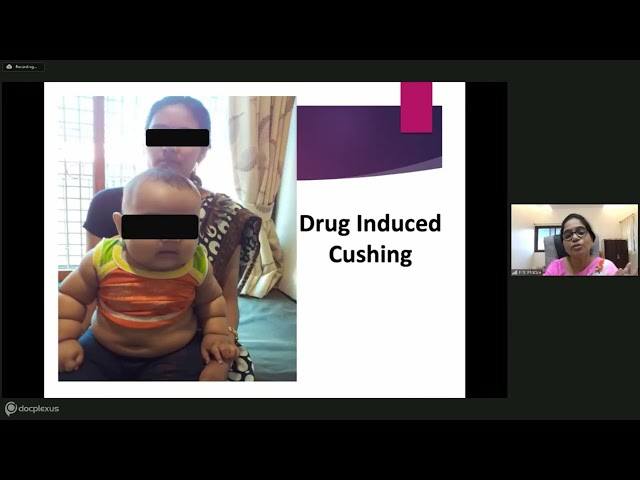 Managing Obesity in Children Dr Priti Phatale