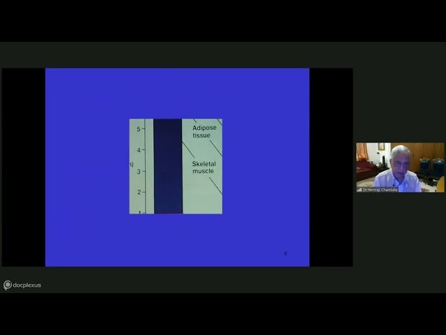 Etio-pathogenesis of Obesity Dr H B Chandaliya