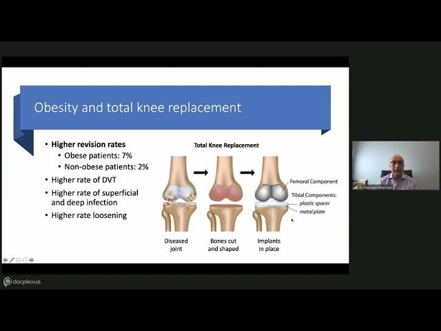 Obesity & Joint Disorders