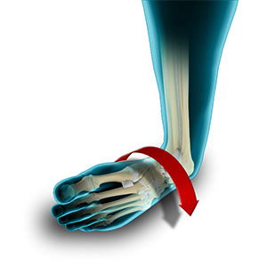 Ankle Instability sp
