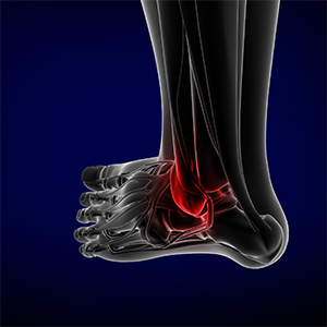 Foot and Ankle Trauma sp
