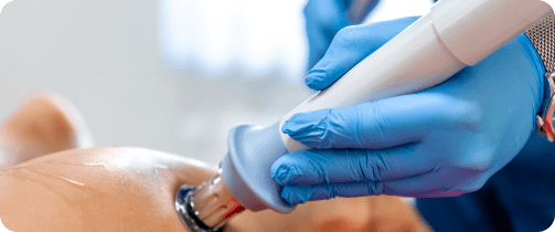 Advanced Treatment Techniques