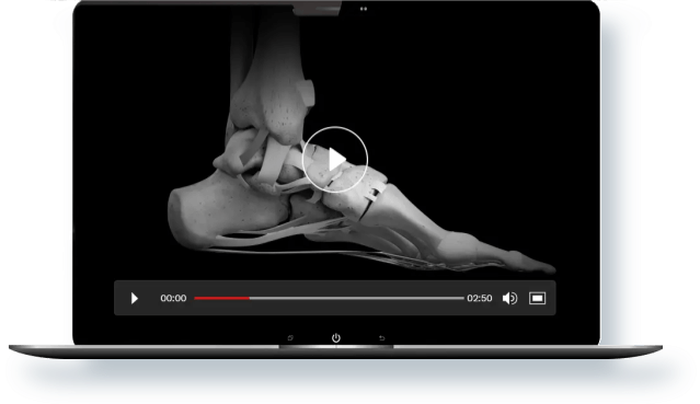 Patient Education Video