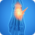 Foot and Ankle Arthritis Picture
