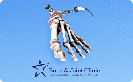 Non-Surgical Foot and Ankle Treatment